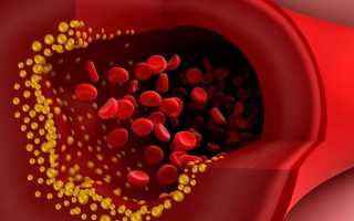 Нормальный уровень холестерина в крови: биологическая роль и опасность, основные осложнения