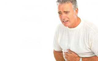Симптомы полипа кишечника: с чем связано заболевание, как себя проявляет и как проводится диагностика