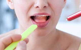 Рак полости рта – современные методы лечения