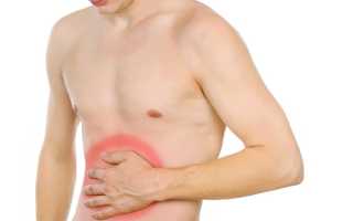 Стеатоз поджелудочной железы: причины, симптомы и лечение