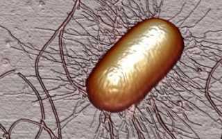 Энтеропатогенная кишечная палочка и другие виды Escherichia coli