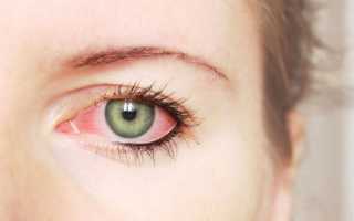 Как снизить глазное давление? Важно выбрать эффективные капли или таблетки