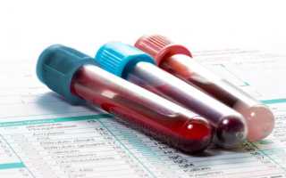 Диастаза крови: значение ее для диагностики болезней