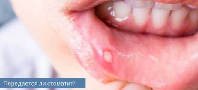 Боль и жжение языка: как лечить?