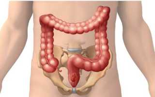 Заболевания ободочной кишки, описание болезней, их лечение и прогноз