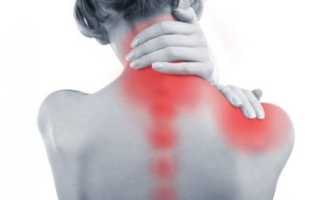 Как избавиться от боли в шее
