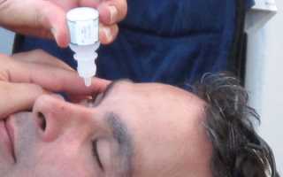 Какие капли от ячменя на глазу эффективнее? Обзор лучших препаратов