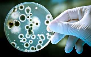 Бактериальная инфекция: симптомы, причины развития и методы диагностики