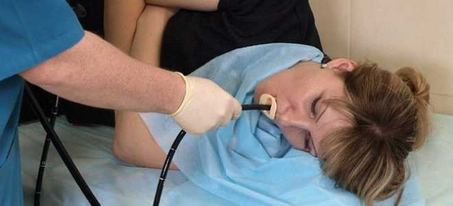 Фиброгастродуоденоскопия как метод исследования пищеварительной системы