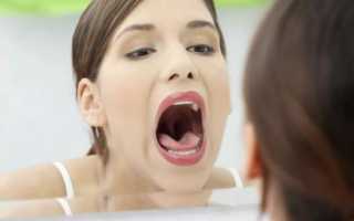Язва во рту, чем лечить заболевание и как проводить профилактику