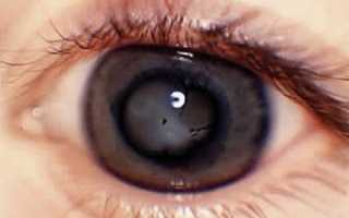 Симптомы отслойки сетчатки глаза: почему заболевание считается опасным?
