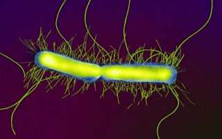 Бактерия протея в пищеварительном тракте человека, насколько это опасно?
