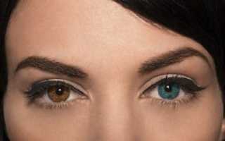 Можно ли с помощью лазерной коррекции изменить цвет глаз? Особенности операции