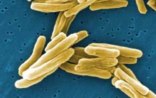 Туберкулез: пути заражения и диагностика заболевания