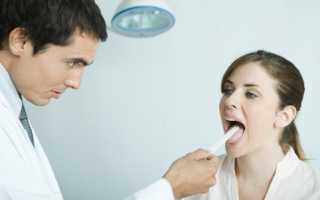 Симптомы рака языка, его лечение и причины возникновения