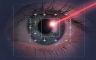 Какие есть противопоказания для проведения лазерной коррекции зрения?