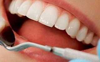 Фторирование зубов: что это и кому полезна данная процедура?