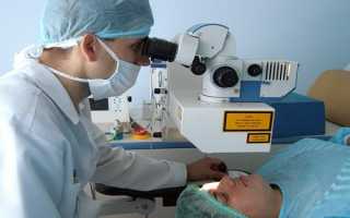 Стоит ли делать лазерную коррекцию зрения: плюсы и минусы проведения процедуры