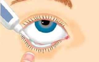 Чем лечить воспаления и покраснения глаз: обзор эффективных мазей