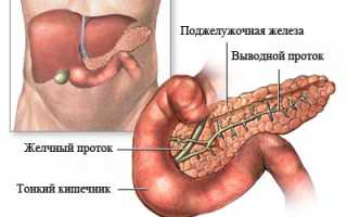 Онкология поджелудочной железы — симптомы и лечение