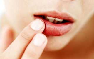Первые признаки рака губы, описание симптоматики по стадиям развития болезни