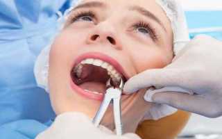 Сколько сохраняется кровяной сгусток в лунке после удаления зуба?