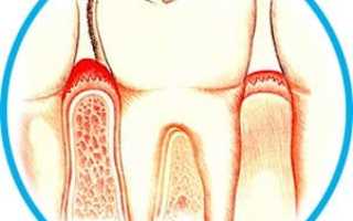 «Зубная» боль — всегда ли причиной являются зубы?