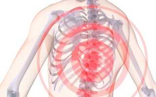 Хондроз грудного отдела: симптомы
