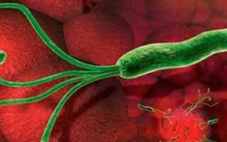 Хеликобактер пилори: какова допустимая норма бактерий для человеческого организма