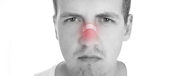 При ушибах лица часто повреждаются глубокие ткани, возникают воспаления, что приводит к невралгии