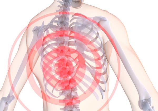 Остеохондроз грудного отдела диагностируется реже, чем остальные виды заболевания
