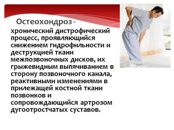 Остеохондроз
