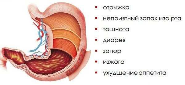 Гастрит