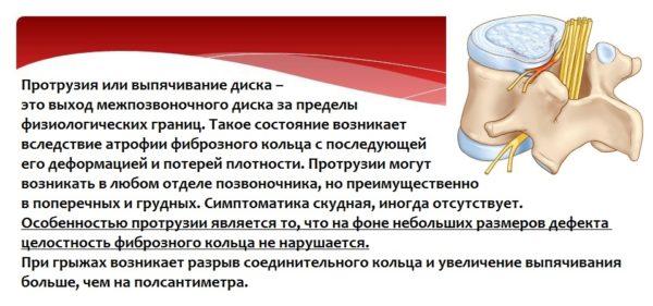 Грыжа и протрузия
