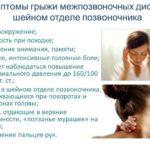 Грыжа шейного отдела позвоночника: симптомы
