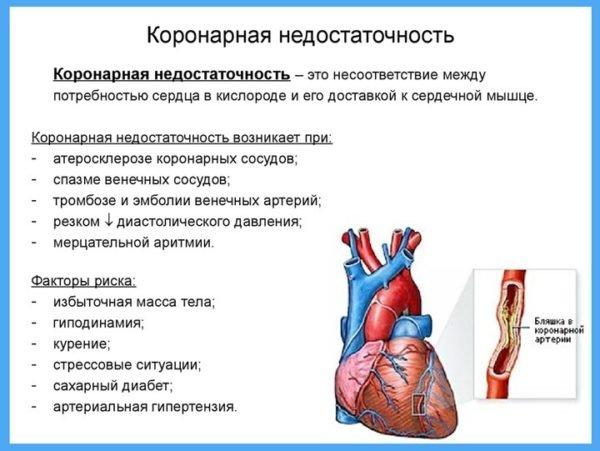 Коронарная недостаточность