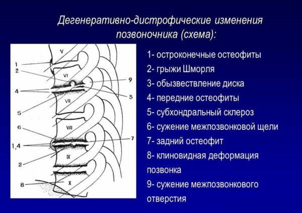 Дегенеративно-дистрофические изменения