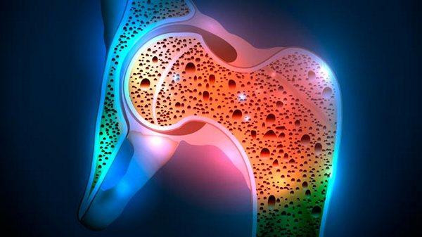 Развиться остеопороз в зрелом возрасте может из-за гормонального сбоя, вызванного нехваткой определенных веществ