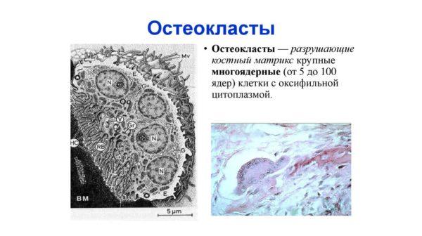 Остеокласты