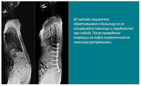 До и после операции