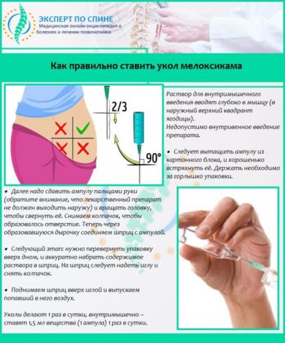 Как правильно ставить укол мелоксикама