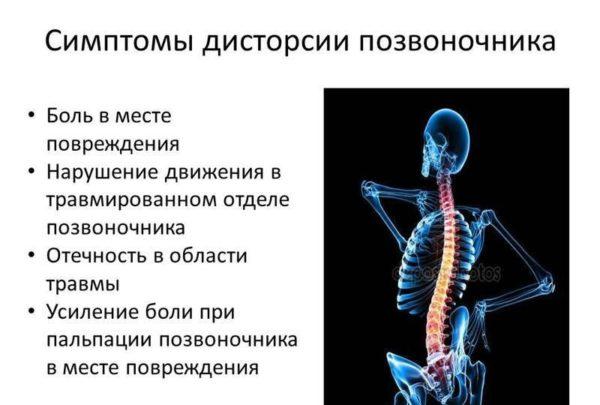 Симптомы дисторсии позвоночника