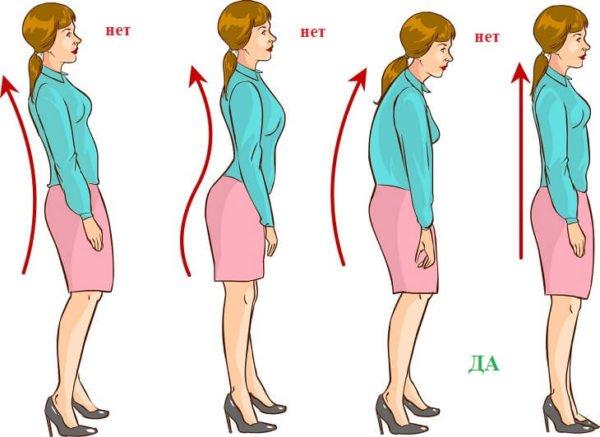 Правильная осанка