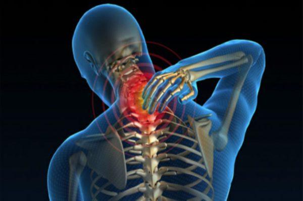Боль в шее — основной симптом миелопатии