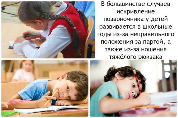 Искривление позвоночника в школьном возрасте
