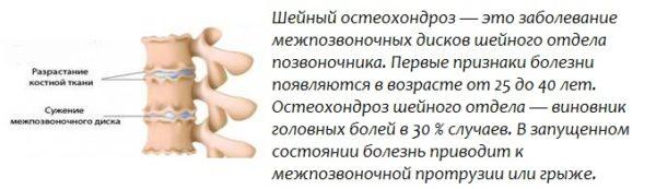 Шейный остеохондроз 