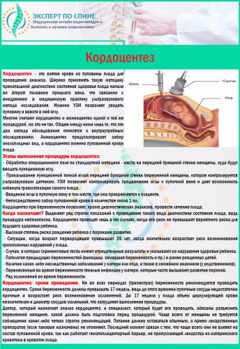 Кордоцентез