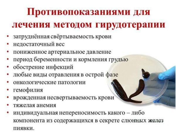 Гирудотерапия: противопоказания