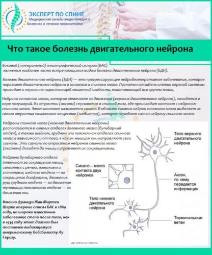 Что такое болезнь двигательного нейрона