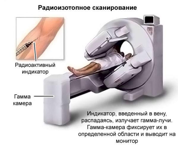 Процедура проведения радиоизотопного сканирования